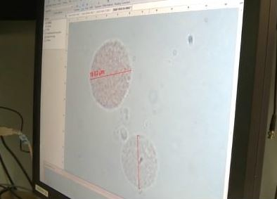 Content Dam Bow En Articles 2017 05 Optical Techniques Could Improve Detection Diagnosis Of Metastatic Melanomas Leftcolumn Article Thumbnailimage File