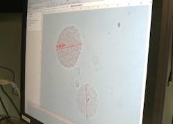 Content Dam Bow En Articles 2017 05 Optical Techniques Could Improve Detection Diagnosis Of Metastatic Melanomas Leftcolumn Article Thumbnailimage File Content Dam Bow En Articles 2017 05 Optical Techniques Could Improve Detection Diagnosis Of Metastatic Melanomas Leftcolumn Article Thumbnailimage File