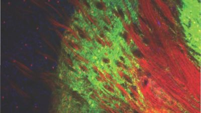 Content Dam Bow Online Articles 2017 05 External Globus Pallidus 853x480 Min2