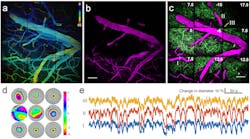 A new type of adaptive-optics (AO) technology for brain research is used here to show corresponding changes in blood vessels and structures called neural dendrites. Each of the three images consists of nine subimages, each created via its own AO subsystem.