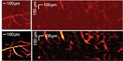 FIGURE 1. Photoacoustic microscopy images show live mouse brain (left column) and human finger cuticle (right column). FIGURE 1. Photoacoustic microscopy images show live mouse brain (left column) and human finger cuticle (right column).