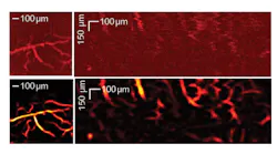 FIGURE 1. Photoacoustic microscopy images show live mouse brain (left column) and human finger cuticle (right column).