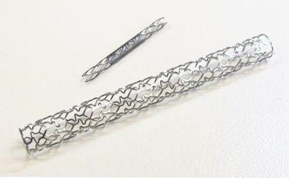 FIGURE 1. Examples of common features in modern stents.