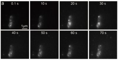 Content Dam Bow Online Articles 2017 07 Blinking Ecoli Web