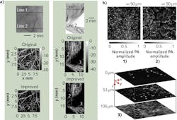 FIGURE 3. Photoacoustic microscopy images show (a) mouse ear (left column) and leg (right column), while (b) shos images of mouse epithelial tissue from the lip (1) and intestinal villi (2), and live tissue with cell nuclei from mouse ear skin (3). FIGURE 3. Photoacoustic microscopy images show (a) mouse ear (left column) and leg (right column), while (b) shos images of mouse epithelial tissue from the lip (1) and intestinal villi (2), and live tissue with cell nuclei from mouse ear skin (3).