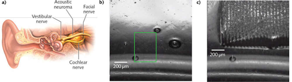 Fiber Lasers: 2 μm thulium fiber laser offers precision surgery promise