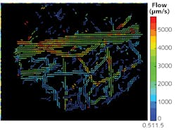 Analysis of high-resolution intravital z-section imagery enables generation of 3D flow maps depicting the microvascular network in a healthy mouse brain; velocity is noted in μm/s. Analysis of high-resolution intravital z-section imagery enables generation of 3D flow maps depicting the microvascular network in a healthy mouse brain; velocity is noted in μm/s.