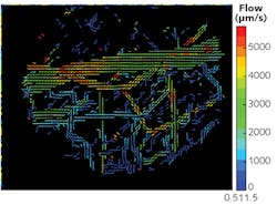 Analysis of high-resolution intravital z-section imagery enables generation of 3D flow maps depicting the microvascular network in a healthy mouse brain; velocity is noted in &mu;m/s.