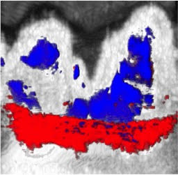 Content Dam Bow Online Articles 2017 09 Photoacoustic Ultrasound Image