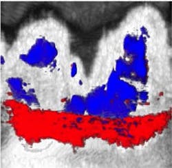 Content Dam Bow Online Articles 2017 09 Photoacoustic Ultrasound Image Content Dam Bow Online Articles 2017 09 Photoacoustic Ultrasound Image
