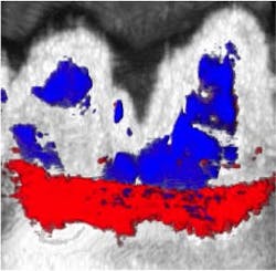 Content Dam Bow Online Articles 2017 09 Photoacoustic Ultrasound Image Content Dam Bow Online Articles 2017 09 Photoacoustic Ultrasound Image