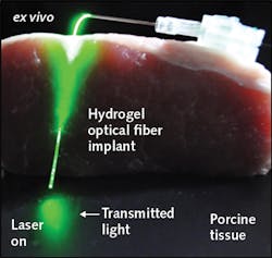 Content Dam Lfw Print Articles 2017 09 1709lfw Nb F3 Content Dam Lfw Print Articles 2017 09 1709lfw Nb F3