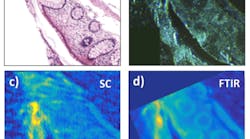 First demonstration of long-wavelength supercontinuum spectral imaging of tissue. Shown are (a) a gold-standard H&E stained microscope image, a (b) visible-light transmission image of the sample, a (c) supercontinuum image obtained by point scanning, and a (d) standard FTIR image obtained with a 128 x 128 focal plane array. First demonstration of long-wavelength supercontinuum spectral imaging of tissue. Shown are (a) a gold-standard H&E stained microscope image, a (b) visible-light transmission image of the sample, a (c) supercontinuum image obtained by point scanning, and a (d) standard FTIR image obtained with a 128 x 128 focal plane array.