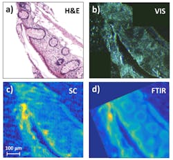 First demonstration of long-wavelength supercontinuum spectral imaging of tissue. Shown are (a) a gold-standard H&E stained microscope image, a (b) visible-light transmission image of the sample, a (c) supercontinuum image obtained by point scanning, and a (d) standard FTIR image obtained with a 128 x 128 focal plane array. First demonstration of long-wavelength supercontinuum spectral imaging of tissue. Shown are (a) a gold-standard H&E stained microscope image, a (b) visible-light transmission image of the sample, a (c) supercontinuum image obtained by point scanning, and a (d) standard FTIR image obtained with a 128 x 128 focal plane array.