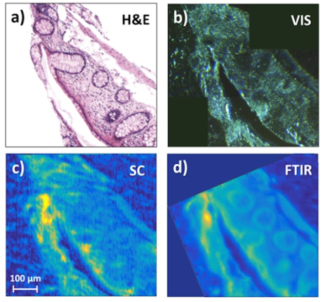 First demonstration of long-wavelength supercontinuum spectral imaging of tissue. Shown are (a) a gold-standard H&amp;E stained microscope image, a (b) visible-light transmission image of the sample, a (c) supercontinuum image obtained by point scanning, and a (d) standard FTIR image obtained with a 128 x 128 focal plane array.