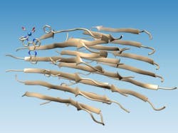 1009 Amyloid 1 Web 1qfeyf3 Web 1009 Amyloid 1 Web 1qfeyf3 Web