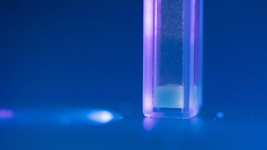 Content Dam Bow Online Articles 2017 11 1009 Amyloid 2 Web 25v75sz Web