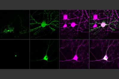 Content Dam Bow Online Articles 2017 11 Mit Single Cell Optogenetics Web