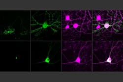 Content Dam Bow Online Articles 2017 11 Mit Single Cell Optogenetics Web Content Dam Bow Online Articles 2017 11 Mit Single Cell Optogenetics Web