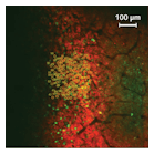 This in vivo two-photon fluorescence image of a mouse brain depicts calcium-indicating protein that is fluorescent in the green channel, while the light-sensitive ion channel is labeled with the red fluorescent mCherry protein to help identify cells for potential targeting by the stimulation laser; the 100 numbered circles mark selected target neurons.