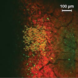 This in vivo two-photon fluorescence image of a mouse brain depicts calcium-indicating protein that is fluorescent in the green channel, while the light-sensitive ion channel is labeled with the red fluorescent mCherry protein to help identify cells for potential targeting by the stimulation laser; the 100 numbered circles mark selected target neurons.