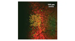 This in vivo two-photon fluorescence image of a mouse brain depicts calcium-indicating protein that is fluorescent in the green channel, while the light-sensitive ion channel is labeled with the red fluorescent mCherry protein to help identify cells for potential targeting by the stimulation laser; the 100 numbered circles mark selected target neurons.