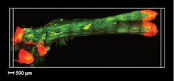 FIGURE 4. A light-sheet microscope captures an image of an adult mouse femur rendered transparent using Bone CLARITY. Osteoprogenitor cells labeled with red fluorescent protein can be seen; autofluorescence (green) provides structural cues. FIGURE 4. A light-sheet microscope captures an image of an adult mouse femur rendered transparent using Bone CLARITY. Osteoprogenitor cells labeled with red fluorescent protein can be seen; autofluorescence (green) provides structural cues.