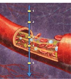 FIGURE 1. Optical coherence tomography-based angiography (OCTA) samples signals from five points in an A-scan (axial scan), three of which (1, 2, and 5) are located in static tissue (that is, not in blood vessels) and two of which (3 and 4) are within a functional blood vessel. OCT signals from the vasculature—points 3 and 4—show dynamic changes over time, while signals from the other points remain steady. FIGURE 1. Optical coherence tomography-based angiography (OCTA) samples signals from five points in an A-scan (axial scan), three of which (1, 2, and 5) are located in static tissue (that is, not in blood vessels) and two of which (3 and 4) are within a functional blood vessel. OCT signals from the vasculature—points 3 and 4—show dynamic changes over time, while signals from the other points remain steady.
