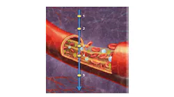 FIGURE 1. Optical coherence tomography-based angiography (OCTA) samples signals from five points in an A-scan (axial scan), three of which (1, 2, and 5) are located in static tissue (that is, not in blood vessels) and two of which (3 and 4) are within a functional blood vessel. OCT signals from the vasculature—points 3 and 4—show dynamic changes over time, while signals from the other points remain steady.