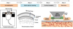 Schematic diagram of skull optical clearing window (SOCW) technique, which has four steps: immobilization, skull optical clearing, cortical imaging, and recovery. A custom-built head immobilization device consists of a skull-holder; a custom-built plate is used to reduce motion artifact during imaging. Anatomical structure of mouse skull consists of spongy bone between two layers of dense bone. In the SOCW, a layer of plastic wrap is placed over the cleared skull to separate the water-immersion objective from the optical clearing agent (OCA).