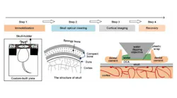 Schematic diagram of skull optical clearing window (SOCW) technique, which has four steps: immobilization, skull optical clearing, cortical imaging, and recovery. A custom-built head immobilization device consists of a skull-holder; a custom-built plate is used to reduce motion artifact during imaging. Anatomical structure of mouse skull consists of spongy bone between two layers of dense bone. In the SOCW, a layer of plastic wrap is placed over the cleared skull to separate the water-immersion objective from the optical clearing agent (OCA).