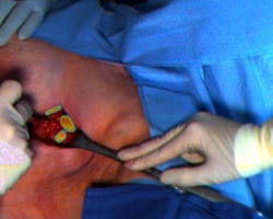 Content Dam Bow Online Articles 2018 04 Rsz Lymph Node Identification Content Dam Bow Online Articles 2018 04 Rsz Lymph Node Identification