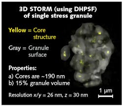 FIGURE 3. Stress granules are subcellular RNA and protein aggregates associated with neurodegenerative disease (for example, amyotrophic lateral sclerosis and frontal temporal lobar dementia); the SPINDLE enabled 3D superresolution imaging and visualization of core substructures within stress granules for the first time. FIGURE 3. Stress granules are subcellular RNA and protein aggregates associated with neurodegenerative disease (for example, amyotrophic lateral sclerosis and frontal temporal lobar dementia); the SPINDLE enabled 3D superresolution imaging and visualization of core substructures within stress granules for the first time.