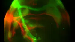 Content Dam Bow Online Articles 2018 05 Webzuker Amygdala Nature Hero 05 24 18