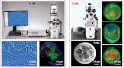 FIGURE 3. Phi Optics offers the SLIM and GLIM technology in the form of upgrade modules that attach via c-mount to any major-brand optical microscope; the SLIM and GLIM channels add to the existing fluorescence capabilities of the microscope seamlessly, offering unlimited combinations of 3D scanning and time series. FIGURE 3. Phi Optics offers the SLIM and GLIM technology in the form of upgrade modules that attach via c-mount to any major-brand optical microscope; the SLIM and GLIM channels add to the existing fluorescence capabilities of the microscope seamlessly, offering unlimited combinations of 3D scanning and time series.