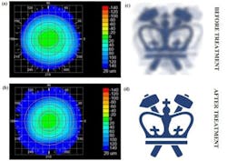 Content Dam Bow Article 2018 6 Vision Correction Web Content Dam Bow Article 2018 6 Vision Correction Web
