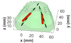 Content Dam Bow En Articles 2018 06 Diffuse Optical Imaging Maps Arteries To Improve Oral Surgery Outcomes Leftcolumn Article Thumbnailimage File Content Dam Bow En Articles 2018 06 Diffuse Optical Imaging Maps Arteries To Improve Oral Surgery Outcomes Leftcolumn Article Thumbnailimage File