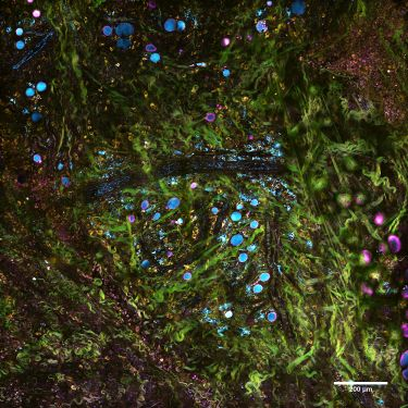 Content Dam Bow En Articles 2018 06 Labelfree Microscopy Method Could Enable Realtime Diagnostics Leftcolumn Article Thumbnailimage File