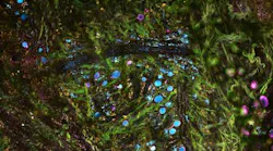 Content Dam Bow En Articles 2018 06 Labelfree Microscopy Method Could Enable Realtime Diagnostics Leftcolumn Article Thumbnailimage File