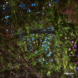 Content Dam Bow En Articles 2018 06 Labelfree Microscopy Method Could Enable Realtime Diagnostics Leftcolumn Article Thumbnailimage File Content Dam Bow En Articles 2018 06 Labelfree Microscopy Method Could Enable Realtime Diagnostics Leftcolumn Article Thumbnailimage File