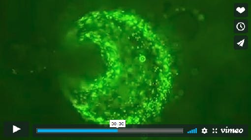 This still from a short video shows how the camera will image the uptake of cancer drugs into tumors, advancing cancer therapy.