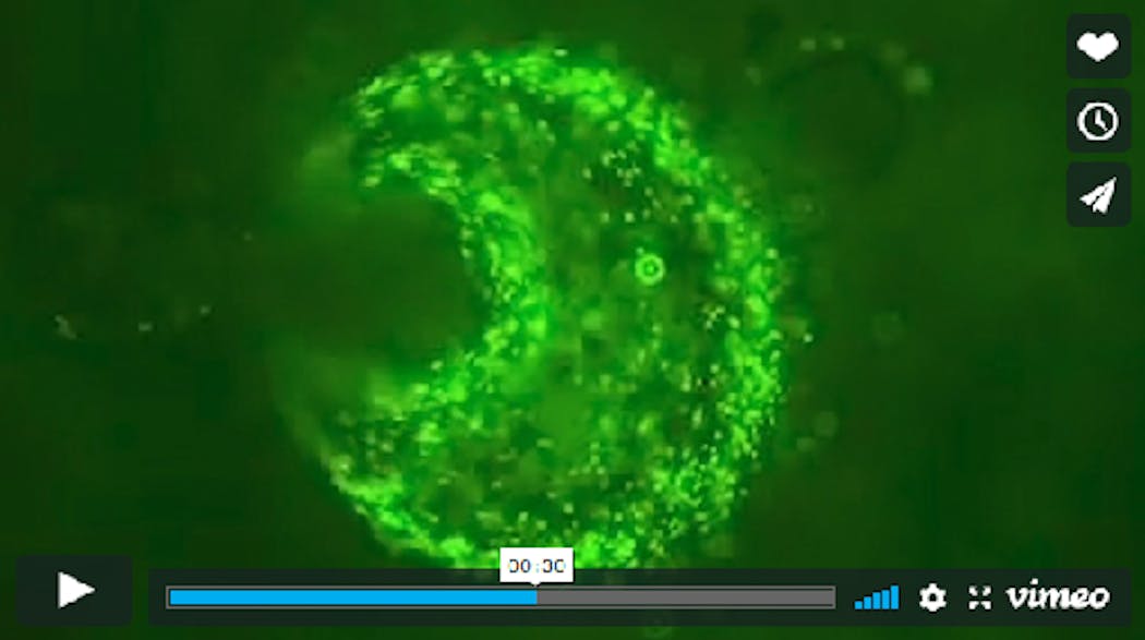 This still from a short video shows how the camera will image the uptake of cancer drugs into tumors, advancing cancer therapy.