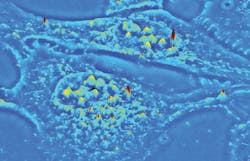 A 3D surface projection of live U-2 OS cell from a SLIM quantitative phase image is shown. A 3D surface projection of live U-2 OS cell from a SLIM quantitative phase image is shown.