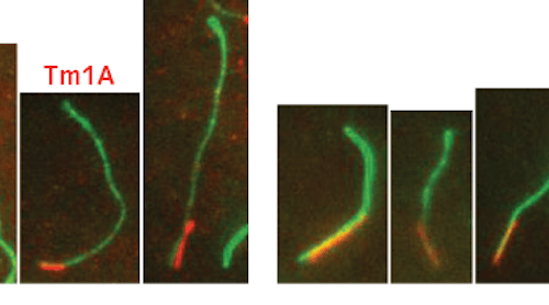 FIGURE 1. These total internal reflection fluorescence microscopy images were obtained using two excitation lasers combined in the Coherent Galaxy laser combiner; as part of research on the binding of actin filaments, the red signal is from Cy5-labeled Tm1A (protein) fluorescence excited at 640 nm, and the green signal is due to Alexa488 labeled actin excited at 488 nm. [1]