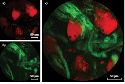 FIGURE 4. Human colon tissue imaged with (a) CARS (red) and (b) SHG (green) using 800 nm pulses is shown, with both modalities in a merged image also shown (c). FIGURE 4. Human colon tissue imaged with (a) CARS (red) and (b) SHG (green) using 800 nm pulses is shown, with both modalities in a merged image also shown (c).