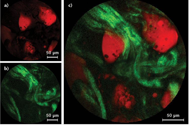FIGURE 4. Human colon tissue imaged with (a) CARS (red) and (b) SHG (green) using 800 nm pulses is shown, with both modalities in a merged image also shown (c).