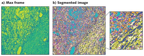 FIGURE 5. PCA (Principal Component Analysis) and K-Means Clustering machine learning algorithms can be applied to a standard false-colored image (a), improving visibility of tissue components (b); pixel groupings are similar spectral profiles (false-colored), and cluster centers can be considered the endmembers or representative spectra.