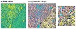 FIGURE 5. PCA (Principal Component Analysis) and K-Means Clustering machine learning algorithms can be applied to a standard false-colored image (a), improving visibility of tissue components (b); pixel groupings are similar spectral profiles (false-colored), and cluster centers can be considered the endmembers or representative spectra. FIGURE 5. PCA (Principal Component Analysis) and K-Means Clustering machine learning algorithms can be applied to a standard false-colored image (a), improving visibility of tissue components (b); pixel groupings are similar spectral profiles (false-colored), and cluster centers can be considered the endmembers or representative spectra.