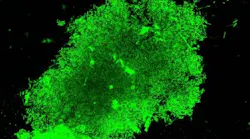 Content Dam Bow Online Articles 2018 08 Fluorescence Tuberculosis