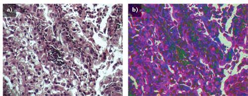 FIGURE 3. A raw H&amp;E stained image of lung cancer tissue collected with the HinaLea hyperspectral microscope system under 20X magnification with quartz tungsten halogen lamp illumination (a) is compared to the classified image using a band selection approach with a priori information (b).